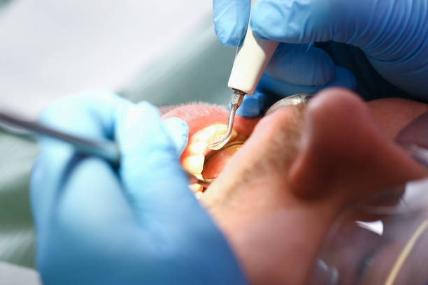 Best Emergency Dental Services for Seniors in Raven, VA